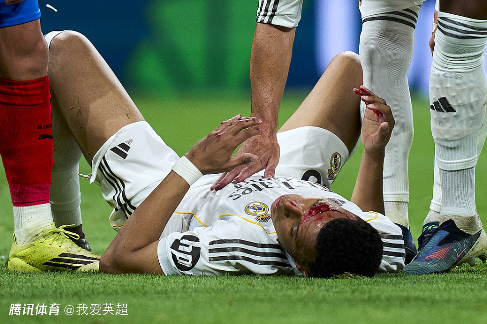 争议？姆巴佩被打脸+流血！主裁拒判点球 皇马官方怒斥：西甲暗箱操作