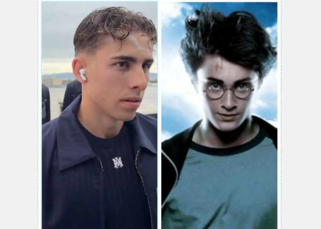 逆转的信号？亚马尔打趣费尔明额头伤疤：太像哈利波特了