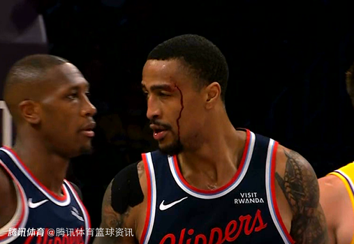 愿无大碍！科林斯空接被海斯犯规重摔倒地 头部出血已被搀扶下场