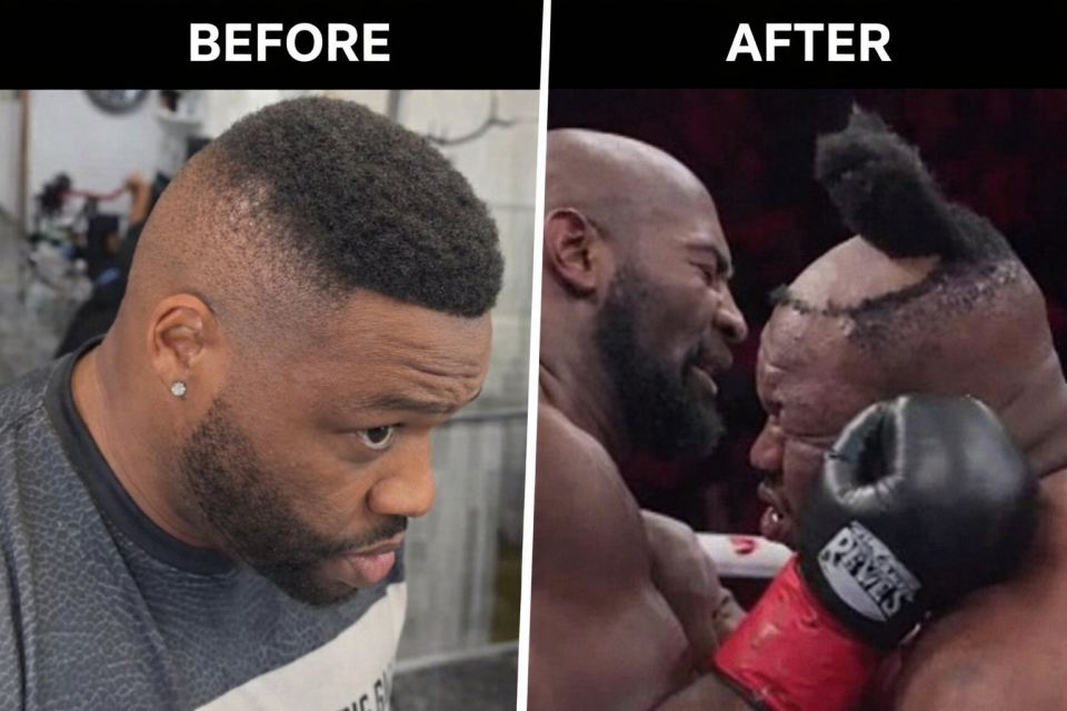 美国拳手假发遭重拳打飞 “秃”然获胜！网友调侃赢了比赛输了头发