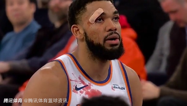 血染赛场！唐斯与琼斯相撞血流不止 如同拳击赛场受伤