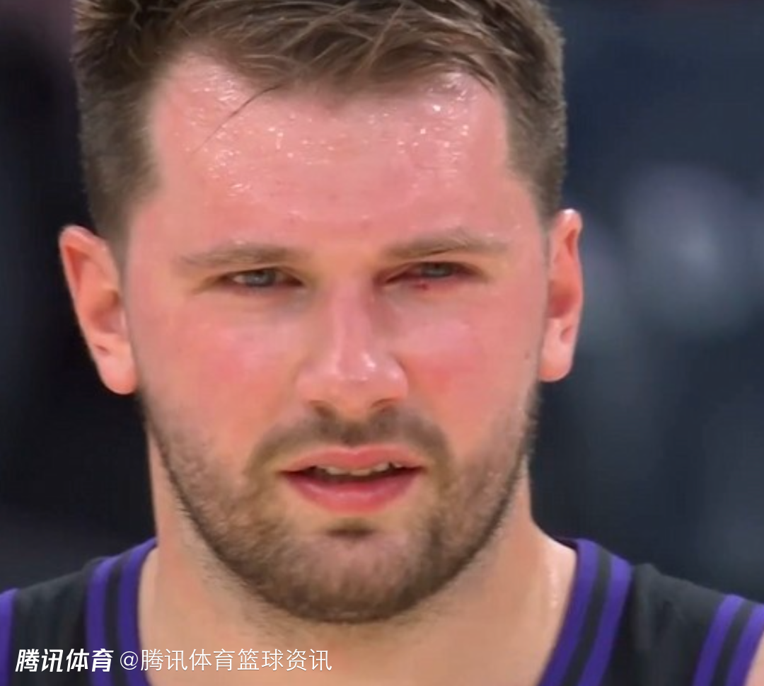 东契奇摘下篮板被大瓦格纳戳到眼睛 伤口非常明显