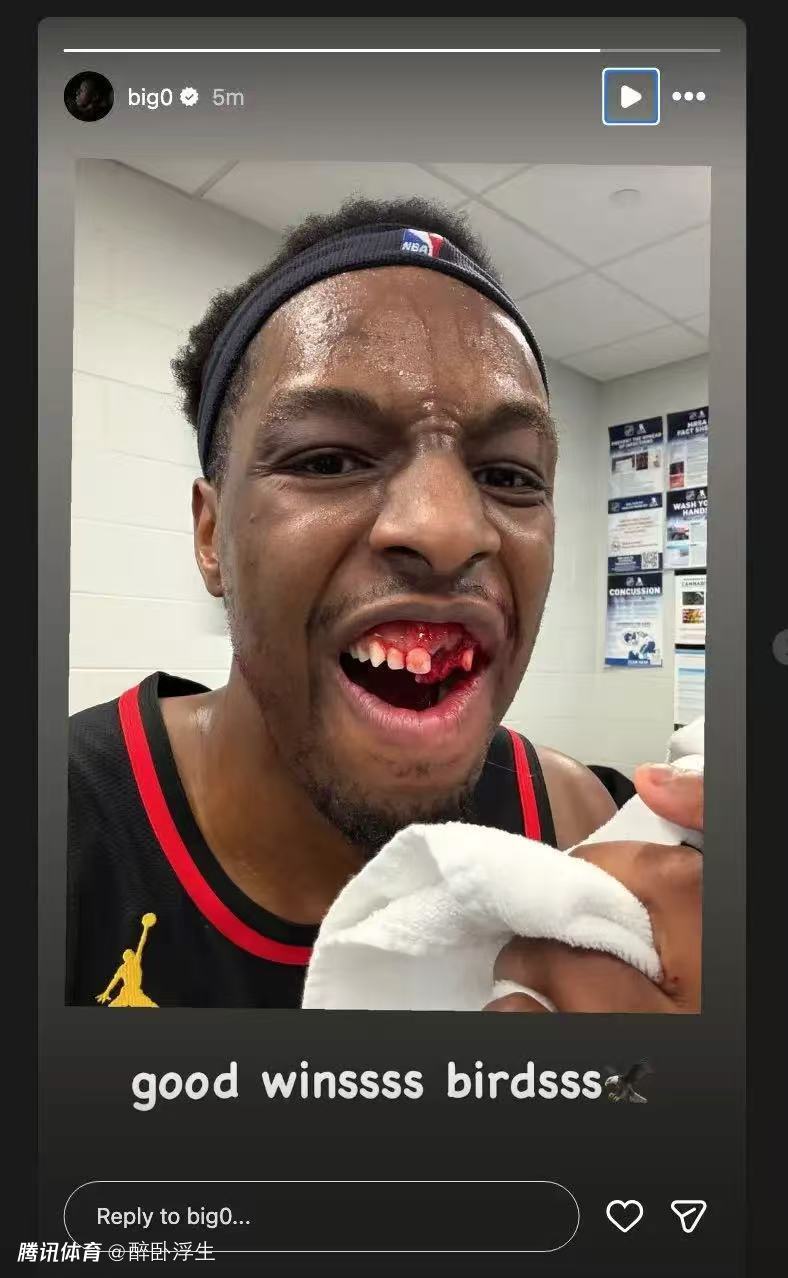 奥孔古遭恶犯被打掉两颗牙：赛后晒照直言好胜心 布朗回应非故意