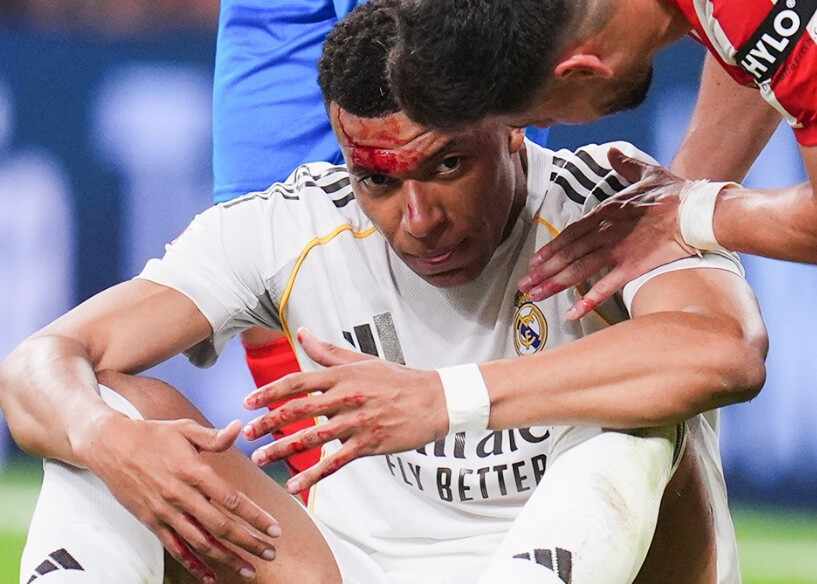 科贝：裁委会将承认姆巴佩被漏判点球，面部出血是决定性依据