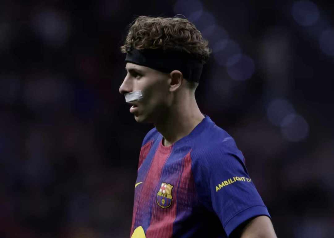 阿斯：因伤后处理不够充分，费尔明的嘴唇需进行二次缝合