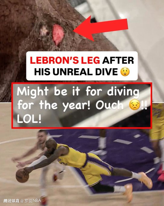 自封年度最佳救球！詹姆斯晒腿部伤口直喊疼 祝贺东契奇当选周最佳