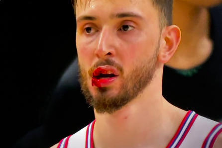 拯救杜兰特！申京最后关头送大帽 起身后嘴唇流血继续打加时