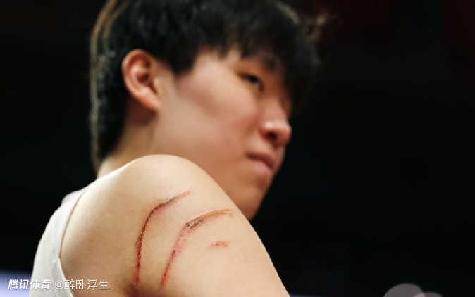 杨瀚森工作室回应小杨被抓出血痕：是伤痕 也是成长路上的拼搏勋章