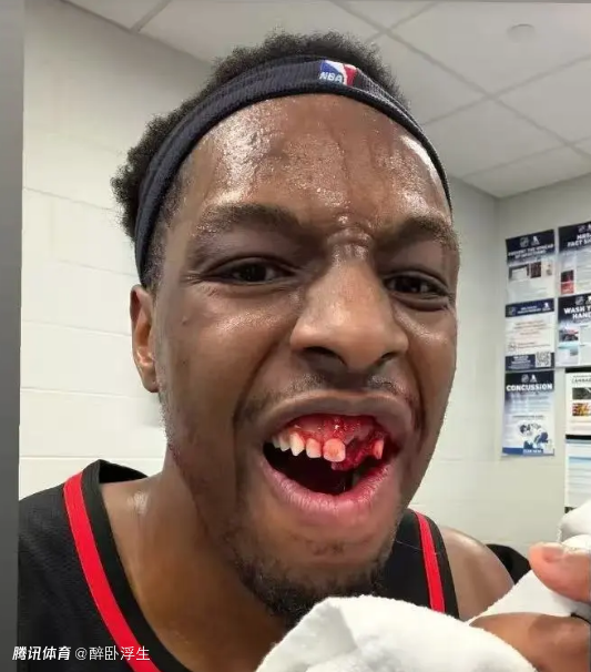 被打掉两颗牙！老鹰官宣奥孔古成功手术 缺席对阵火箭步行者两场